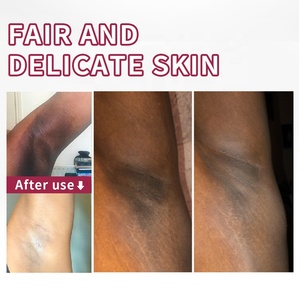 <span class=keywords><strong>Savon</strong></span> Solide Naturel Éclaircissant à la Carotte pour Femmes, à l'Huile Essentielle de Rose et à l'Acide Kojique, Végétalien, du Fabricant - Product Image 4