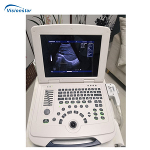 Ubw580 đầy đủ kỹ thuật số hình ảnh 2D 12.1inch HD LCD trung gian hiển thị máy tính xách tay Loại B/W Máy siêu âm - Product Image 3