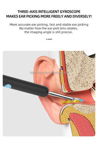 Untuk Bebird Earwax pembersih telinga Visual pintar dengan mikroskop earpick untuk penghilangan kotoran telinga efektif - Product Image 5