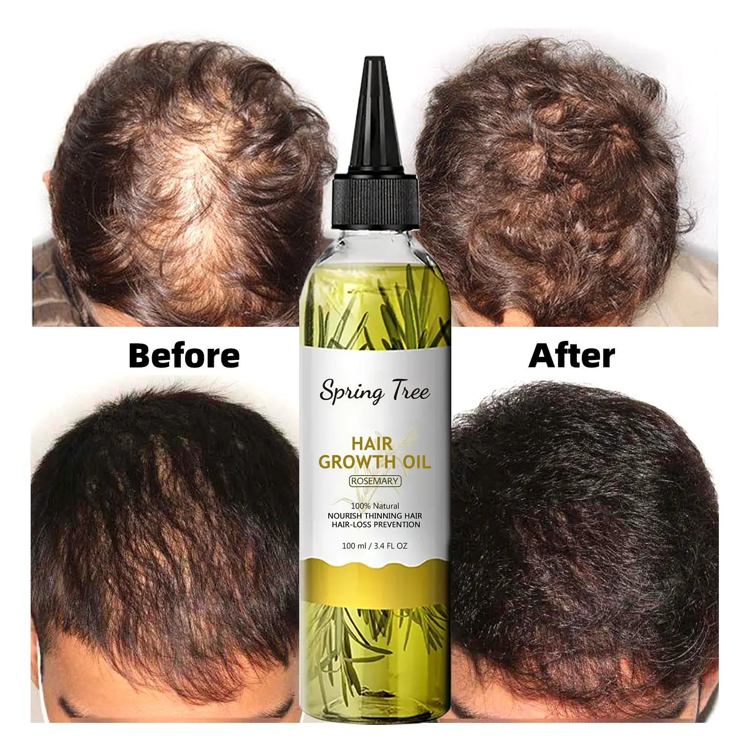 Private Label naturale olio essenziale di rosmarino donna prodotti per la cura dei capelli neri olio di rosmarino crescita dei capelli