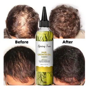 Aceite esencial de Romero orgánico natural de etiqueta privada, productos para el cuidado del cabello negro para mujeres, aceite de romero, crecimiento del cabello