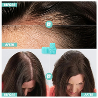 Gummies OEM Biotine Cheveux, Peau et Ongles – 60 Gummies – Vitamines et Suppléments – Collagène, Kératine, Biotine