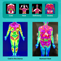 Les applications cliniques de la machine de surveillance thermique intelligente à imagerie thermique numérique