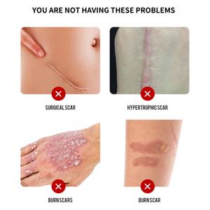 Gel Réparateur et Anti-Cicatrices 20g à Prix Bas en Gros : Soulage l'Inconfort Cutané et Favorise la Santé - Product Image 2