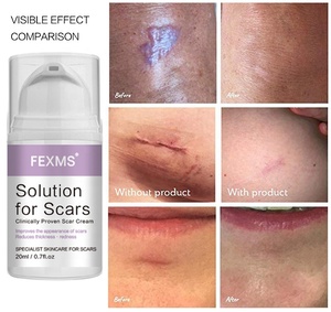 Crema para Cicatrices FEXMS al por Mayor, Fórmula Avanzada, Potente Tratamiento para Cicatrices de Acné Facial, Marca Privada, Crema para Cicatrices - Product Image 4