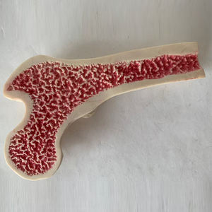 Gran Venta de patología de la osteoporosis y modelo de enseñanza de densidad ósea saludable para estudiar - Product Image 2