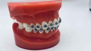 Cina <span class=keywords><strong>Dental</strong></span> ortodontico ortodontico ortodontico produttore di staffe ortodontiche a bordo Standard - Product Image 3