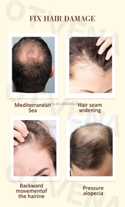 Aceite para el Crecimiento del Cabello OTVENA - Fortalece las Hebras y Reduce la Rotura - OEM/ODM - Product Image 2
