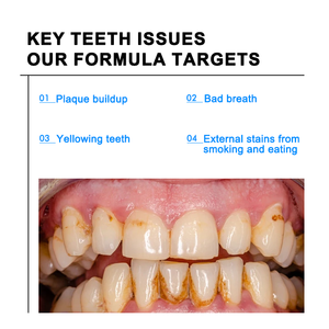 Poudre blanchissante professionnelle au charbon actif, menthe, marque privée personnalisée, accessoire buccal multi-usages pour les soins dentaires à domicile - Product Image 4