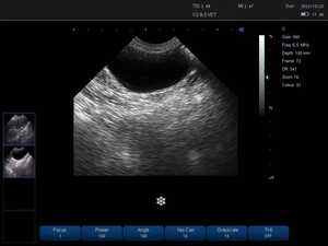 Escáner <span class=keywords><strong>de</strong></span> Ultrasonido Veterinario Portátil en Blanco y Negro, Máquina <span class=keywords><strong>de</strong></span> Ecografí<span class=keywords><strong>a</strong></span> Veterinaria <span class=keywords><strong>de</strong></span> Mano para Perros, Mascotas y Animales, <span class=keywords><strong>Precio</strong></span> del Dispositivo <span class=keywords><strong>de</strong></span> Ultrasonido - Product Image 6