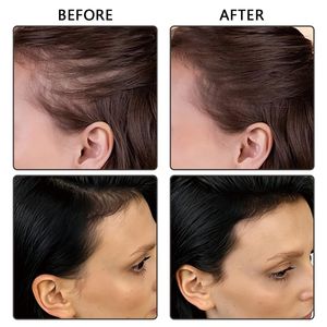 Polvo para Retoque de Raíces Resistente al Sudor, Polvo para Colorear la Línea del Cabello, Resistente al Agua, Marca Privada, Realza la Línea del Cabello - Product Image 5