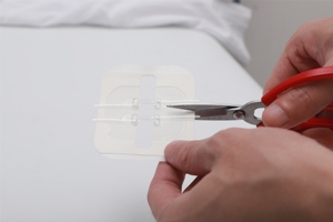 Kit de Suturas de Cierre Rápido Longmed, Dispositivo Desechable para Cierre de Heridas, Certificación CE Clase I, Desinfección con Ozono - Product Image 4