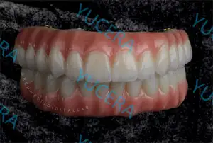 Yucera 4D plus多層ジルコニアブロックCEISO歯科用ジルコニア多層オープンシステムで探索