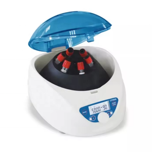 Laboratory Centrifugeuse Machine Beauty <strong>Centrifugal</strong> Benchtop Blood Prp <strong>Centrifugal</strong> Machine - Product Image 4