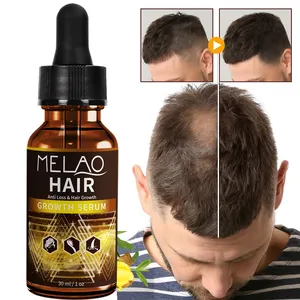 Huile capillaire épaississante bloquant la DHT naturelle de marque privée MELAO Sérum pour le cuir chevelu chauve Vente en gros Huile anti-chute stimulant la croissance des cheveux