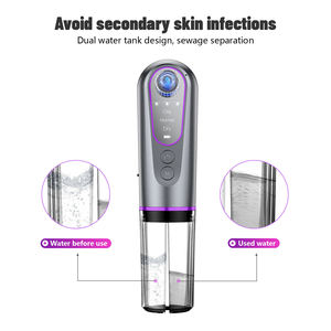 Máquina Eléctrica para el Cuidado de la Piel en Casa, Eliminador de Sebo, Eliminador de Puntos Negros de la Nariz y el Rostro, Aspiradora de Agua <span class=keywords><strong>Facial</strong></span>, Exfoliante de Succión de Sebo - Product Image 4