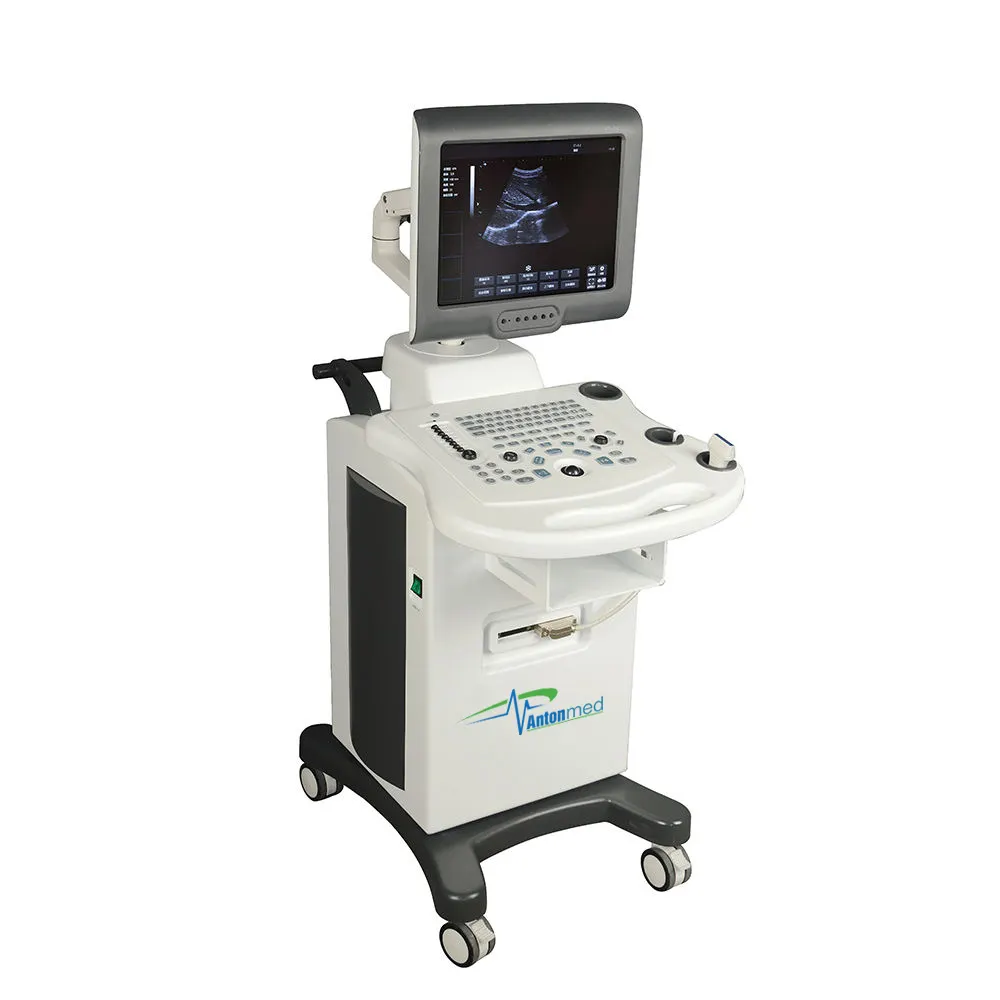 Fábrica Produção Color Doppler Mindray Ultrasound Machine Venda Direta Ultrasound Scanner Mindray