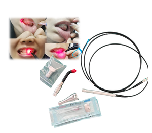 Máquina de Belleza con Láser de <span class=keywords><strong>Diodo</strong></span> de 980nm para Eliminación de Hongos en las Uñas, Arañas Vasculares, Vasos Sanguíneos, Blanqueamiento Dental con Láser de <span class=keywords><strong>Diodo</strong></span>, Curación de Heridas - Product Image 5