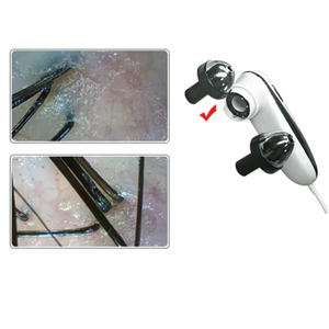 Analisador de Cabelo para Cuidado do Crescimento Capilar, Câmera de Couro Cabeludo, Tricoscópio, Máquina de Análise de Folículos Capilares - Product Image 3