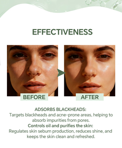 Bandelettes adhésives pour le nez : film rétractable pour resserrer les pores, éliminer les points noirs, extraire l'acné, <span class=keywords><strong>masque</strong></span> réparateur profond pour comédons fermés - Product Image 3