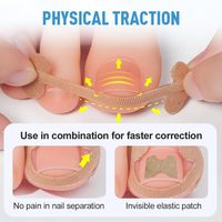 Kit de correcteur d'ongles professionnel de vente chaude outils de Correction de Paronychia soin des pieds incarnés patch correcteur d'ongle d'orteil