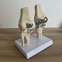 Modèle de prothèse de genou artificielle détachable KyrenMed, petit modèle d'implant de genou double argenté