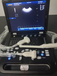 CE Meilleur <span class=keywords><strong>Prix</strong></span> Échographe Portable 3D Couleur Doppler pour Clinique et Hôpital SUN-906A - Product Image 5