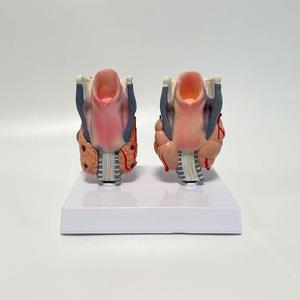 Modello Anatomico di Confronto Tiroideo Sano e Anormale, Due Esemplari per l'Esposizione della Struttura della Tiroide, Modello per Biologia Endocrina - Product Image 3