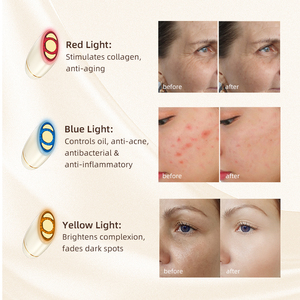 Dispositivo Facial Profesional de Doble Punta, <span class=keywords><strong>Cepillo</strong></span> Limpiador y Masajeador para Uso Doméstico, Reafirmante de la Piel y Potenciador de la Absorción de Suero - Product Image 2