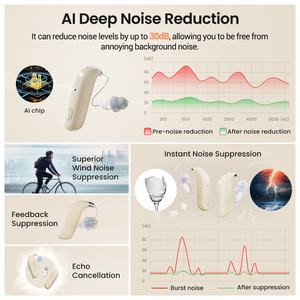 Shenzhen Flysounds <span class=keywords><strong>Medical</strong></span> Technology RIC BTE Prothèse auditive Fréquence étendue 8000Hz Clip Protector et anti-perte Caractéristiques - Product Image 3