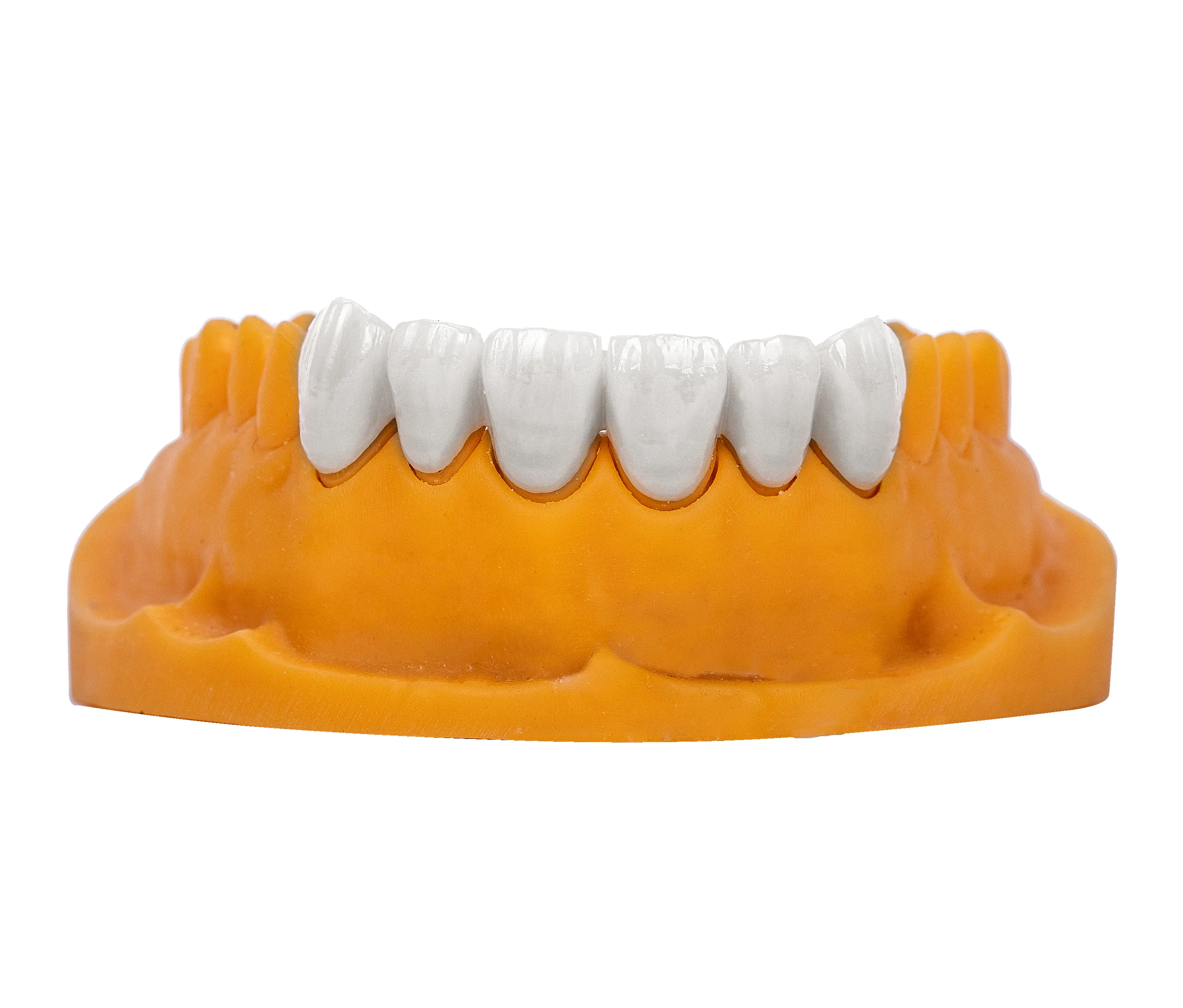 Cad-Cam glass Veneer all-ceramic tooth all-ceramic denture 3D printing design denture high-end customization