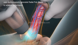Aparato de Ondas de Choque de Alta Calidad para la Disfunción Eréctil y el Tratamiento de la Prostatitis - Product Image 4