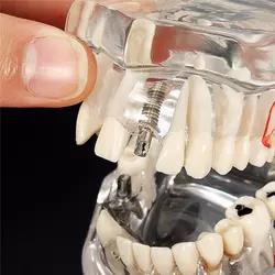 Modelo de dientes <span class=keywords><strong>para</strong></span> enseñanza Dental y entrenamiento - Product Image 4