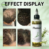 Sérum capillaire bio naturel OEM pour la prévention de la chute des cheveux, soin du cuir chevelu à la menthe et au romarin, huile essentielle pour diffuseur.