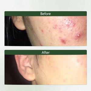 Ensemble de soins de la peau à l'aloe vera naturel coréen OEM <span class=keywords><strong>Lotion</strong></span> et toner à l'extrait d'aloe vera hydratant et apaisant <span class=keywords><strong>pour</strong></span> produits <span class=keywords><strong>pour</strong></span> le <span class=keywords><strong>visage</strong></span> - Product Image 4