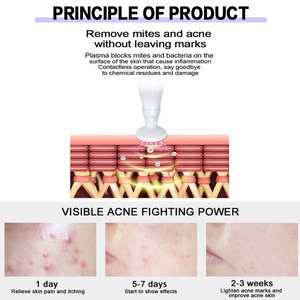 Mini stylo à plasma froid pour la beauté, stylo à ozone pour le lifting du visage, stylo à fibroblastes pour le soin de la peau, nettoyage en profondeur, élimination des points noirs, stylo à plasma ozone - Product Image 4