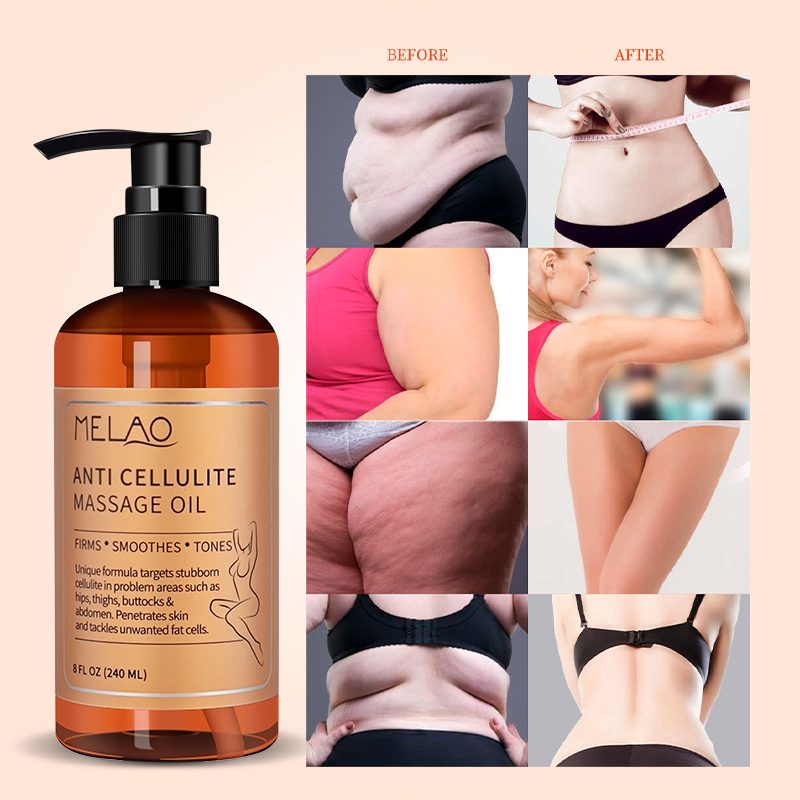 Private Label 100% Natural Skin Slimming Body Tightening and Firming Anti Cellulite Massage Oil Treatment for Women and Men
