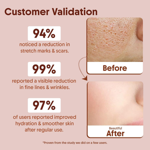 Aceite corporal orgánico de vitamina E al por mayor, 30 ml, hidratante, vegano, para el rostro, productos de belleza DIY - Product Image 4