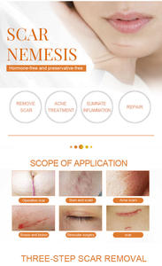 ครีมบำรุงผิวลดรอยแผลเป็นและซ่อมแซมรอยแผลเป็นสีขาวมาใหม่2025 - Product Image 5