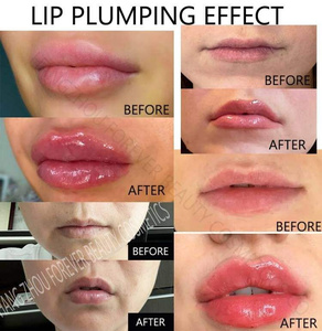 Brillo Labial Voluminizador Personalizado con Péptidos y Ácido Hialurónico, Protector Solar FPS 30, Producto de Belleza al por Mayor, Relleno Labial - Product Image 5