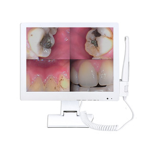 Système de caméra intra-orale dentaire Meiliguang M-978 de 17 pouces avec scanner de code QR Wi-Fi et moniteur d'imagerie médicale - Product Image 1