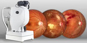 China oftalmal Retina Camera SK-650B Eye Test Camera Retina Fundus Camera - Product Image 3