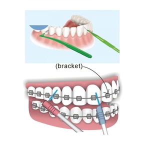 Cepillo Interdental en Forma de L de 7 Colores, Mango Ergonómico, Eliminación de Placa, Marca Privada OEM - Product Image 4