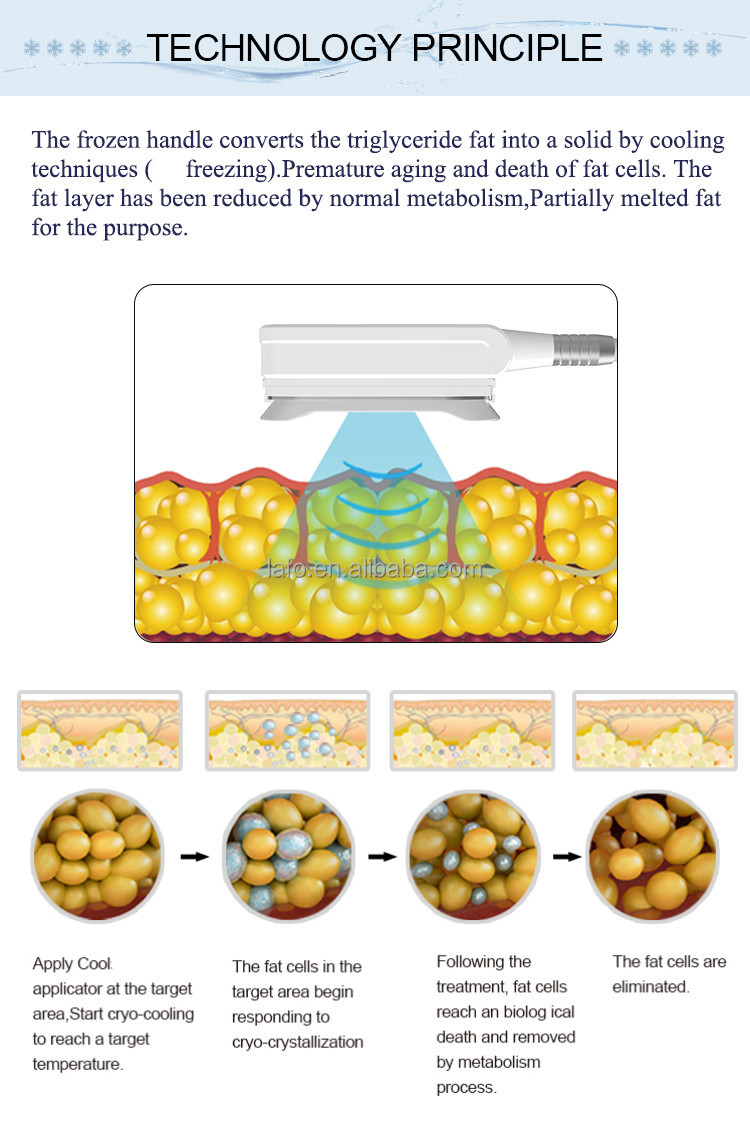 Professional stationary 360 Cool system Cryolipolysis Weight Loss Cryo Double Chin Removal Machine LF-245B