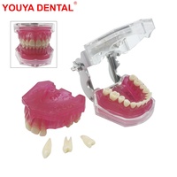 YOUYA DENTAL Modèle Anatomique Dentaire Standard MX-039, Dents Amovibles, Gencives Souples, Typodont pour l'Étude et l'Enseignement en Dentisterie