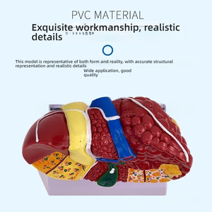 Modèle de foie en plastique PVC coloré Caractéristiques pathologiques cliniques communes Aide à la communication pour les médecins en hépatologie Gastroentérologie - Product Image 5