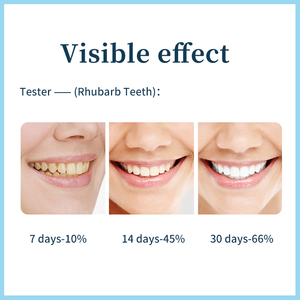 Nuovo dente in polvere naturale <span class=keywords><strong>bicarbonato</strong></span> di sodio forza sbiancamento dei <span class=keywords><strong>denti</strong></span> in polvere pulizia dei <span class=keywords><strong>denti</strong></span> in polvere <span class=keywords><strong>per</strong></span> anti-cavità Private Label AE9231 - Product Image 4