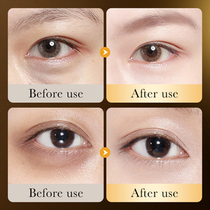 Crema de Ojos ZOZU OEM ODM con Ácido Hialurónico y Oro de <span class=keywords><strong>24k</strong></span>, Hidratante, Antiarrugas, la Mejor para las Ojeras - Product Image 6