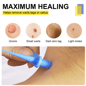 Kit de Eliminación de Verrugas ELAIMEI 2 en 1, Herramienta Indolora para Eliminar Verrugas, 40 Bandas, Envío Inmediato, Disponible en Almacén en el Extranjero - Product Image 5