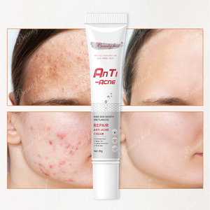 Crema Natural de Marca Privada para Eliminar Cicatrices de Acné, Eficaz y Fuerte, Elimina Granos, Antiacné, Elimina Manchas Oscuras - Product Image 4